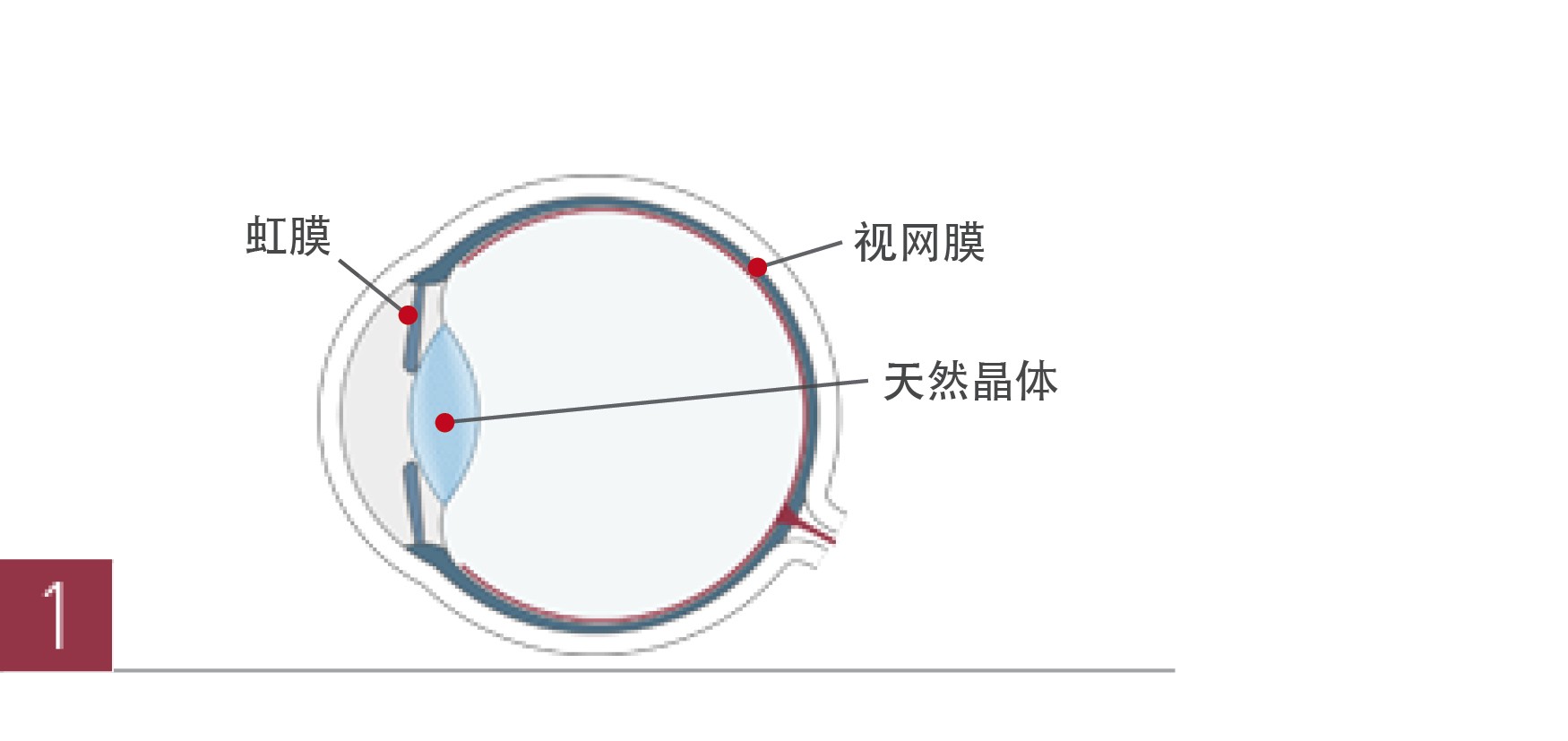 激光手术老花眼价格