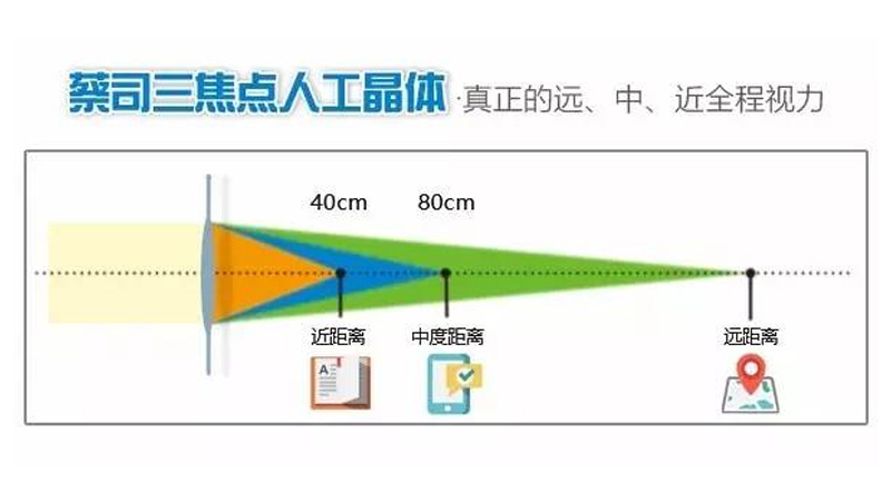 老花眼有什么方法能矫正呢？HugoBoss全球总裁有答案